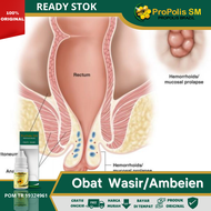 Obat Wasir Obat Ambeien Amp Obat Cair Wasir Obat Ambeien Wasir Obat Hemoroid Obat Wasir Ambeien Amp 