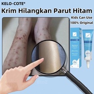Scar removal cream Baby black scar removal cream foot scar cream acne scar scar scar removal