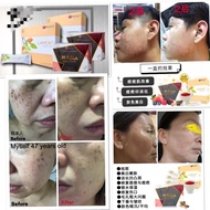 iMono LAMOR2 Remove Freckle & MAMA Balance Hormone 胶原蛋白肰祛斑王 平衡荷尔蒙 Memudarkan Bintik Hitam & Menyeimb