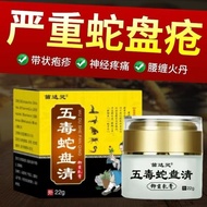 Syndrome of herpes zoster, snake sore cream, snake gallbladder, spider sore, flying带状疱疹后遗症蛇盘疮乳膏蛇胆疮蜘蛛