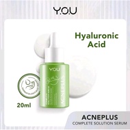 YOU AcnePlus Complete Solution Serum 20ml