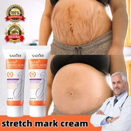 Stretch Mark Removal Cream Ori BPOM Stretch Mark Treatment Cream Anti Stretchmark Cream Safe For And