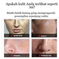 NEW HB [ PAKETAN ] DARK SPOT MELASMA REMOVAL FUYAN SERUM & FUYAN FLEK