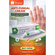 Econazine Cream Gatal 20g Krim Kulat Panau Kurap Gatal Anti Fungus