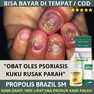 Obat Kuku Rusak Berjamur - Obat Jamur Kuku Kaki Tangan Kuku Cantengan Bau Bernanah Kering Hitam Busu