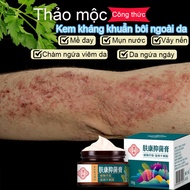 Anti-allergic Anti-Itch Cream From Eczema Itchy Skin Fungal Skin Cream Antipyretic Cream 30g
