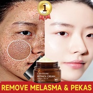 Krim jeragat whitening freckle cream dark spot remover freckles removal face cream whitening Moisturizer Anti Wrinkle祛斑霜