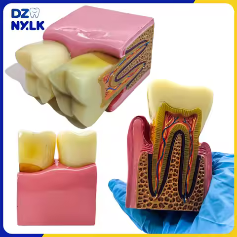8Times Dental Caries Teeth Model Periodontitis Case Analysis Teeth Model for Dental Demonstration Mo