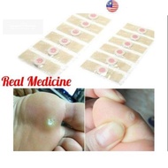 [ Remove The Corns ] Paste Clavus Patch Corn Medicated Plaster JIYANTIE Paste Foot Corn Plasters