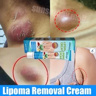 Lipoma Removal Cream Lymphatic detox removal Axillary Swelling Lymph Node Dispersing Cream Reduce Sw