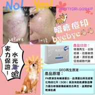 Geoskincare 再生針