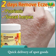 Ready Stock,siapPsoriasis Cream Antifungal cream Eczema cream Cream gatal kulit 20g krim gatal kulit