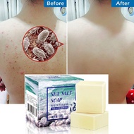 3Pcs Removal Pimple Pores Acne Treatment Sea Salt Soap Cleaner Goat Milk Moisturizing Face Care Wash Basis for Skin Care