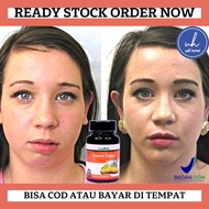 Obat Wajah Tidak Simetris Obat Bibir Miring Obat Perawatan Bells Palsy Obat Pengembali Rahang Tidak