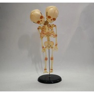 Fetal fetus Skeleton teaching educational Model Double Head Baby Skull Skeleton Anatomy model