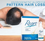 Regro 5% Lotion 80ml Original For Hair Loss Treatment (Clinically Proven Results) Long Expiry