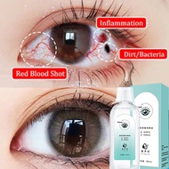 Eye Care Liquid 200ml Well-eye cleaning eye high Relief of eye fatigue volume sterilization student 
