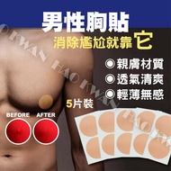 Breast Patch Male Nipple Bump Dew Point [W373]