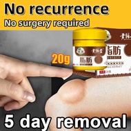 Lipoma Cream lipoma removal cream lipoma cream original lipoma removal cream original Multiple remov