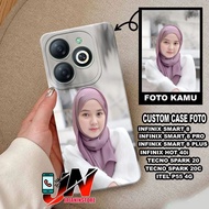 Case Use Your Own Photo Infinix SMART 8 / 8 PRO / 8 PLUS HOT 40I / SPARK 20 / SPARK 20C / ITEL P55 4
