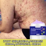 2024 Original Psoriasis Treatment Cream 30G Psoriasis Ointment Original Gamot Sa Kati Kati Sa Balat 