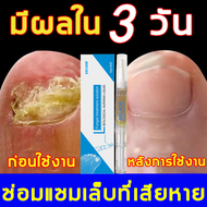 【7วันเจอผล】เซรั่มบำรุงเล็บ เชื้อราเล็บมือ แก้เชื้อราที่เล็บ บำรุงเล็บ ลากับเล็บเสีย ไม่ทำร้ายเล็บดี（