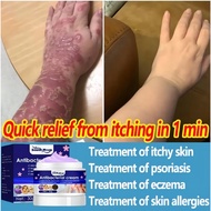 Anti Bacterial Eczema Cream Anti Itching Psoriasis Cream 30g Atoderma Cream Gamot sa kati kati sa ba