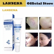 ^LANBENA Acne Treatment Cream Acne Scar Removal Cream