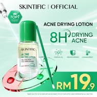 【AntiAcne】SKINTIFIC Acne Drying Lotion Salicylic Acid Acne spot treatmen Acne Scar Serum Essence uba