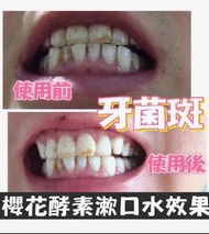 櫻花漱口水