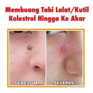 (READY STOCK) QULIT / RINAKI - Krim Buang Tahi Lalat/Ketuat/KutilKolestrol Yang Berkesan dan Sampai 