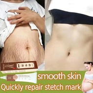 ✙  Pregnant Scar Repair Cream Stretch Marks Removal Women Skin Care Acne Scars Remove  Maternity Fat Striae Gravidarum Body Care