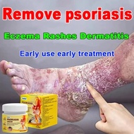 Psoriasis Cream 20g Eczema Ointment Quickly Itching Repair Removes Antifungal creamand
