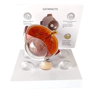 Cornea Eyeball Model Human Eye Model Human Eye Demonstration Teaching Prop Cataract Anatomy Medical 