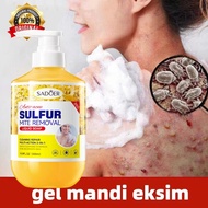 SADOER Eczema sabun mandi cair body wash Pengobatan Eksim eksim kering Kurap gatal kulit jamur kulit eksim lotion eksim