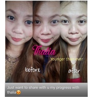 Thalia Beauty Cream (penghapus jeragat tebal dan parut jerawat)
