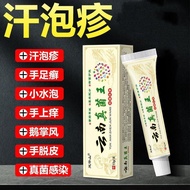 Krim Tangan Kaki Kulit Kasar Jangkitan Kulat Air Kaki Melepuh Mengelupas Retak Kulit Radang Eksim Kr