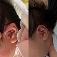 Baby Ear Profile Corrector Baby Ear Shaping Sticker Lop Ear Recruiting Style Ear Shaping Newborn Sil