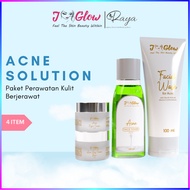Jglow Acne Whitening Package – Acne & Dull Skincare – 4 Pcs