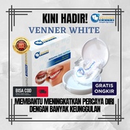 TERLARIS Snap On Smile Venner White Perapih Gigi Terlaris