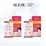 [แพ็กคู่ สุดคุ้ม]ALESE Dark Spot And Melasma Concentrate Cream 7 g 1 กล่อง (6x7g) ครีมเนื้อเซรั่มสูต