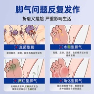 Athlete's Foot Odor Spray Foot Cream 7.1 Athlete's Foot Anti-itching Athlete's Foot Cream Rotten Spr