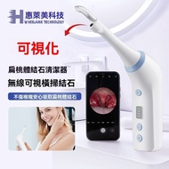 [Visible Version] Tonsil Calculus Remover Oral Cleaning Care Tool Oral Cleaning Care Tool Calculus R