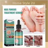 EELHOE Paronychia repair solution/Nail repair solution/Nail Fungus Treatment Penyelesaian pembaikan 