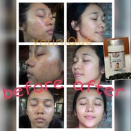 PROMO COLLAGEN SOFTGEL WOO TEKH PEMUTIH PERMANEN AMPUH Limited