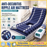 2Days⭐Malaysia+COD⭐ Anti-Decubitus Ripple Air Mattress 200x90cm Alternating Pressure Mattress with A