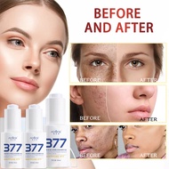 377 Whitening Anti-freckle Essence Brightening Dark Skin 30ml -377美白烟酰胺精華祛斑七老板小杨哥推荐澳芙雪正品symwhite精华液3