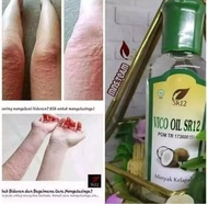 OBAT BIDURAN PALING AMPUH OBAT BIDURAN GATAL ALERGI DINGIN OBAT BIDURAN UNTUK ANAK OBAT BIDURAN DEWA