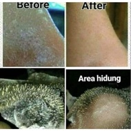 Original beef bone gelatin / gelatin blackhead mask (halal)