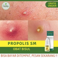 Obat Alami Bisul Anak Sampai Dewasa Obat Oles Buat Bisul Obat Bisulan Obat Bisul Bernanah Obat Bisul